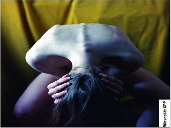 Zdjęcie: Anoreksja i bulimia - choroby XX Iwieku.